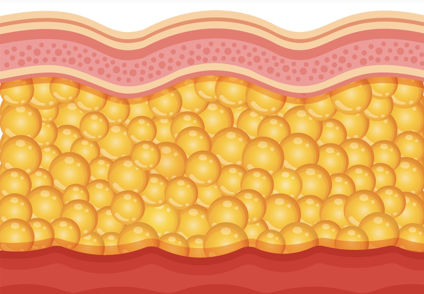Visual comparison of normal skin versus swollen skin due to edema